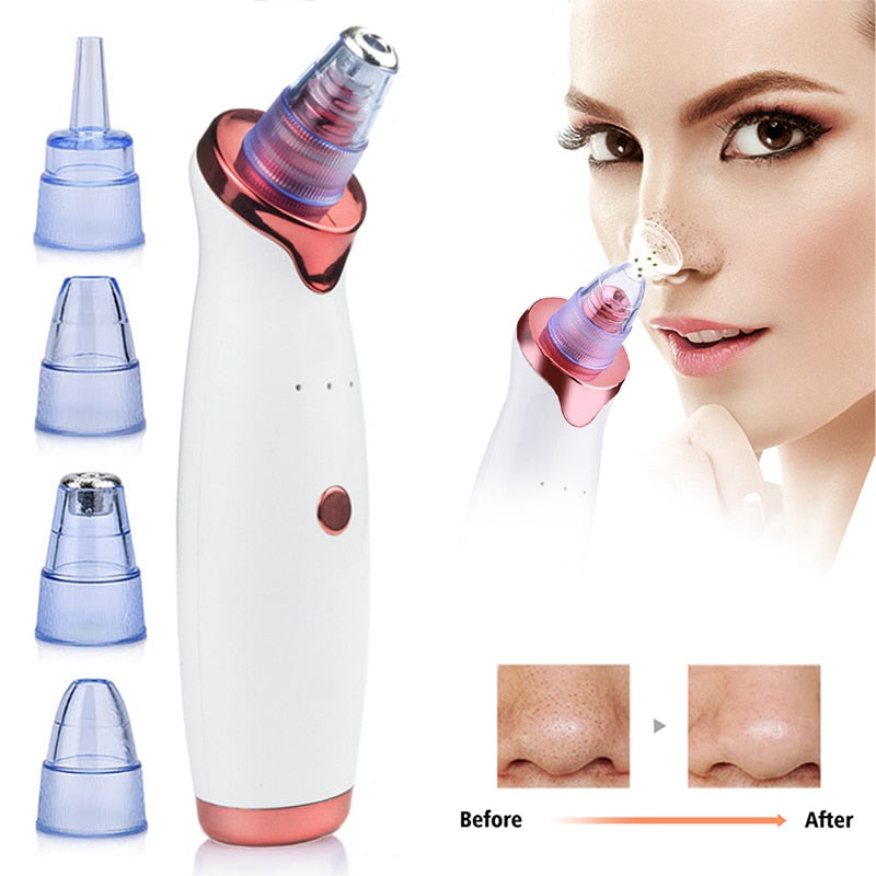 &quot;Derma Vacuum™ Facial Pore Cleanser – Blackhead Remover&quot;