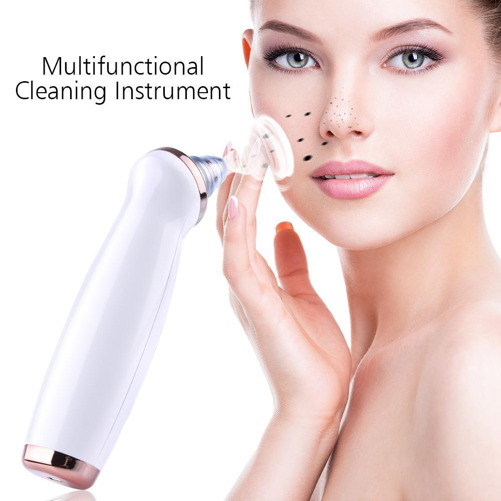 &quot;Derma Vacuum™ Facial Pore Cleanser – Blackhead Remover&quot;